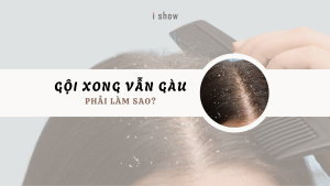 gàu, gội xong vẫn gàu, gàu ngứa, trị gàu
