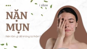 nặn mụn xong nên làm gì để không bị thâm nặn mụn chăm sóc da mụn nặn mụn đúng cách