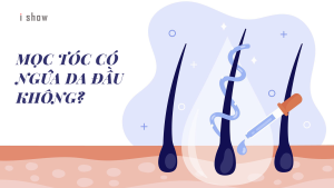 ngứa da đầu ngứa da đầu do mọc tóc con ngứa da đầu nổi mẩn đỏ ngứa da đầu là bệnh gì ngứa da đầu do đâu ngứa da đầu về đêm ngứa da đầu làm sao hết ngứa da đầu gội gì ngứa da đầu do nấm ngứa da đầu phải làm sao ngứa da đầu rụng tóc nhiều ngứa da đầu nổi mụn